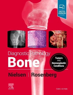 Diagnostic Pathology: Bone by G. Petur Nielsen (English) Hardcover Book