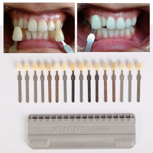 16 Colors Shade Guide Teeth Dental Materials For VITA A1-D4 Whitening Comparison - Picture 2 of 10