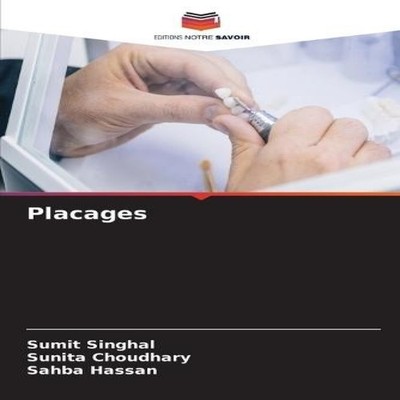 Placages SUMIT SINGHAL Paperback KS OmniScriptum Publishing