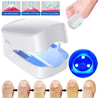 Laser Nagelpilz Fungal Nail Therapie Lasergerät Fungus Lazer für Heimgebrauch