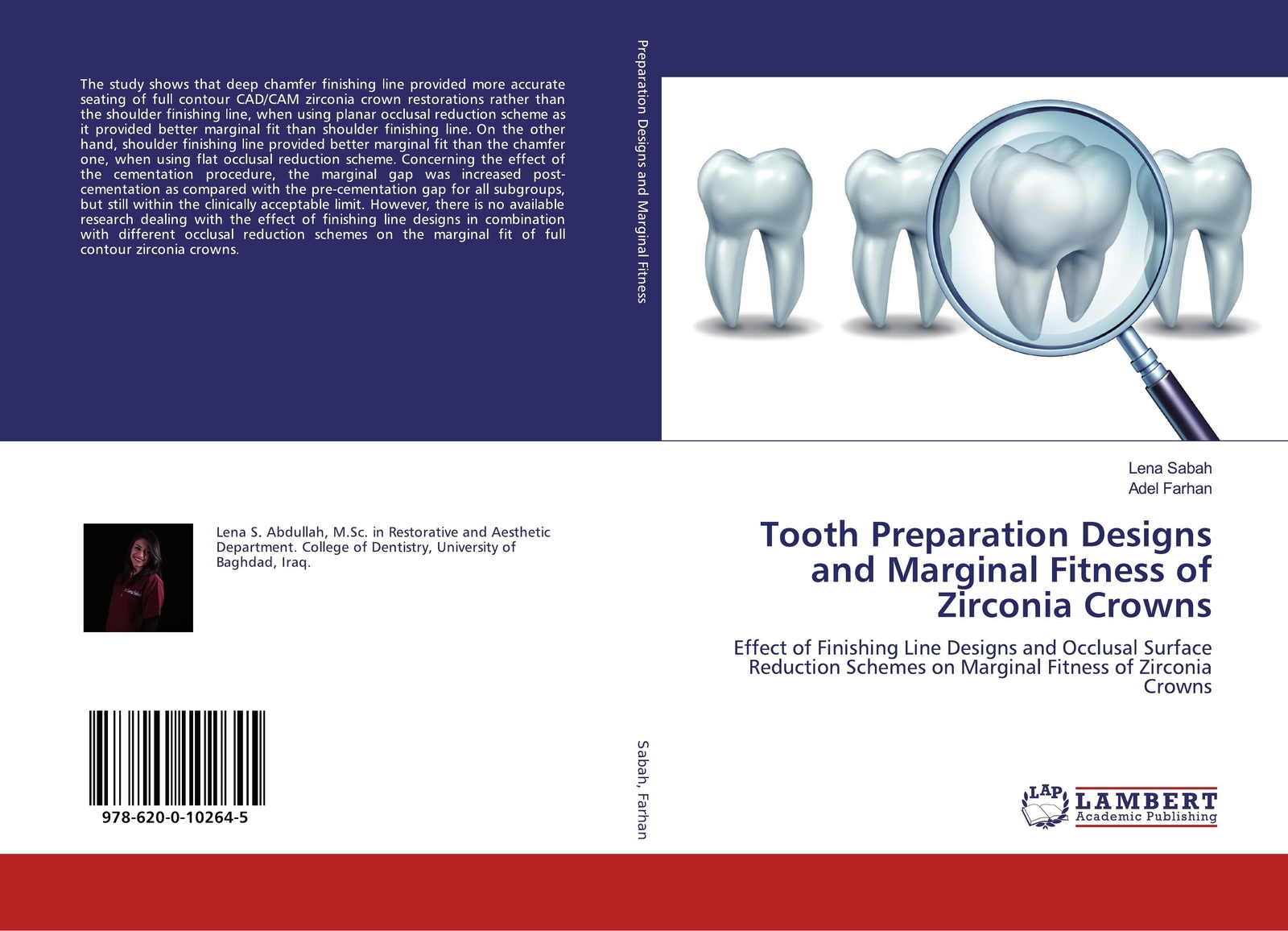 Thumbnail - Tooth Preparation Designs And Marginal Fitness Of Zirconia Crowns |