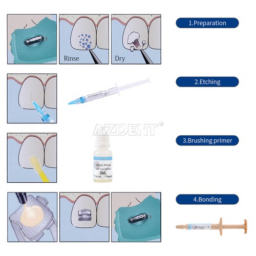 Dental Orthodontic Light Cure Adhesive No-mix Resin Paste Direct Bonding System - Picture 34 of 34