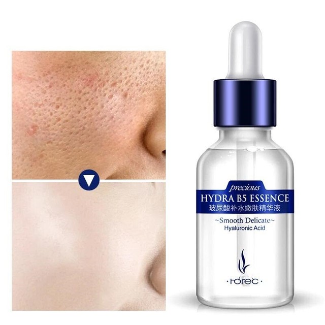 1 ml de ácido hialurónico para que alcanza