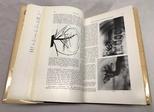1962 1st Ed🚩ENCYCLOPEDIA of UROLOGY V/1-DIAGNOSTIC RADIOLOGY Springer-Verlag - Picture 11 of 12
