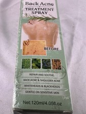 Back Acne Treatment Spray, 2 Salicylic Acid Camellia Sinensis Leaf Oil Exp 6/26