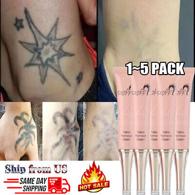 Easy Tattoo Removal Cream - No Pain, Effects