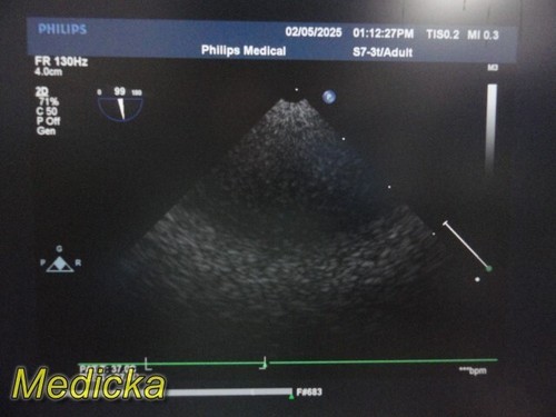 Philips S7-3T Pediatric Transesophageal Ultrasound Probe W/ Carrying Case ~36789 - Picture 5 of 24