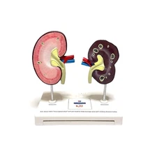 Ultra Vintage Hill s PRESCRIPTION DIET Anatomical Model of Dog Kidney