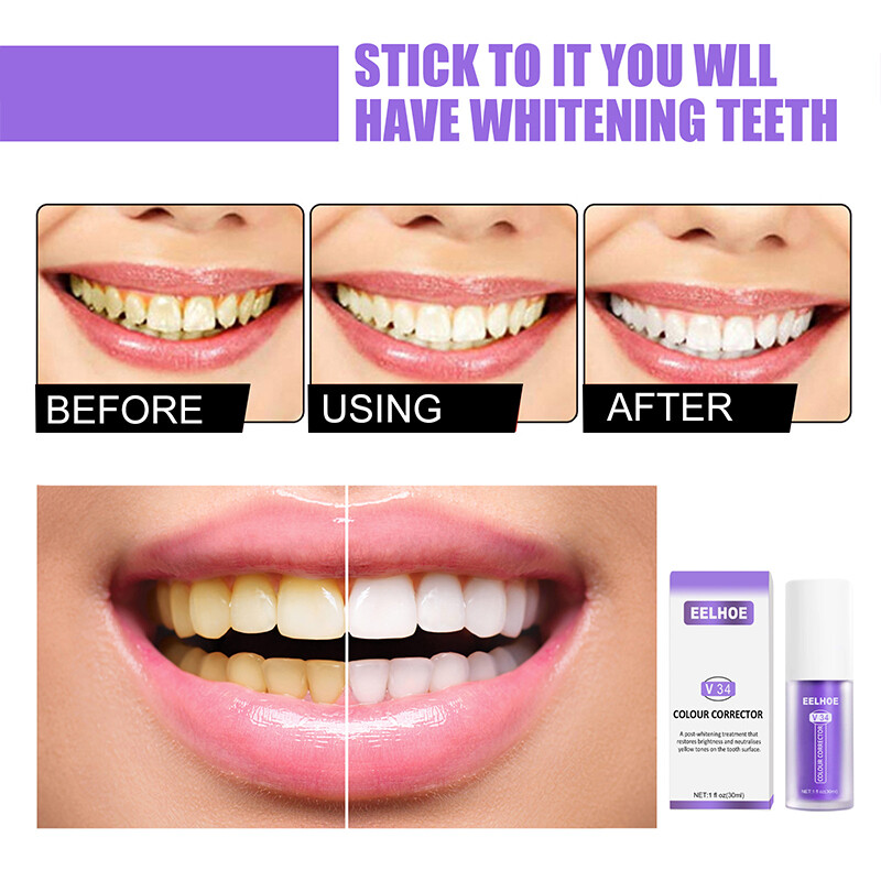 v34 whitening