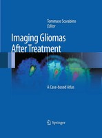 Imaging Gliomas After Treatment | Tommaso Scarabino | A Case-Based Atlas | Buch