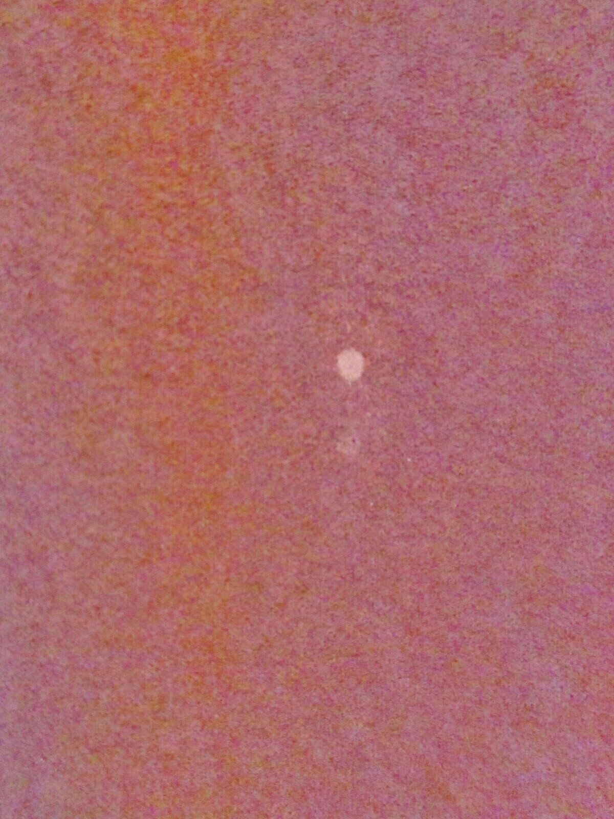 Picture 10 of 11