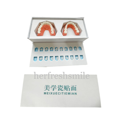 Dental Composite Veneer Template Model Practise Veneers Dentist Teaching