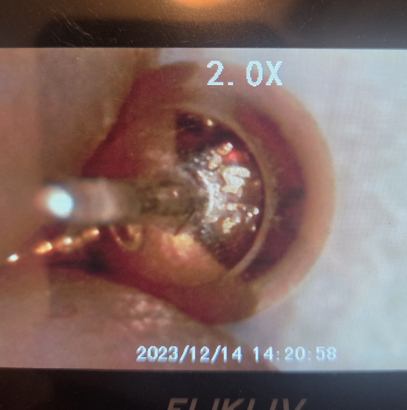 Solid 14k Gold Pinecone Dangle Earrings 4 Grams - image 5