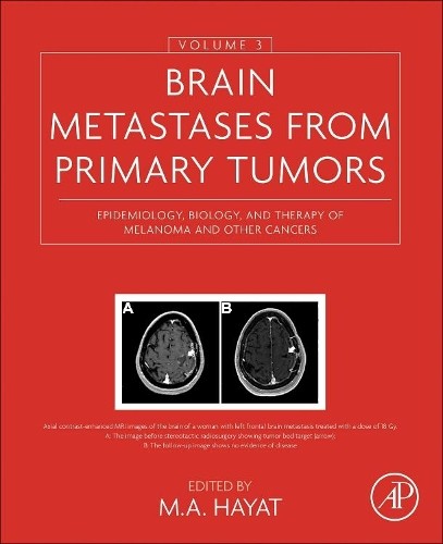 Brain Metastases from Primary Tumors, Volume 3 - 9780128035085