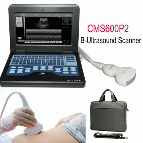 Digital Portable Ultrasound Machine Laptop Scanner with 3.5Mhz Convex Probe CE - Afbeelding 1 van 10