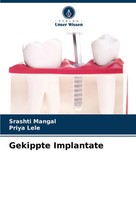 Srashti Mangal (U. A.) | Gekippte Implantate | Taschenbuch | Deutsch (2024)