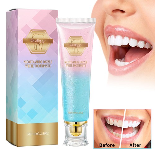 100g Niacinamide Whitening Toothpaste-Remove Stains, Fresh Breath & Enamel Care - Picture 2 of 14