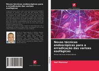Novas TéCnicas EndoscóPicas Para A ErradicaçãO Das Varizes EsofáGicas Loai Manso
