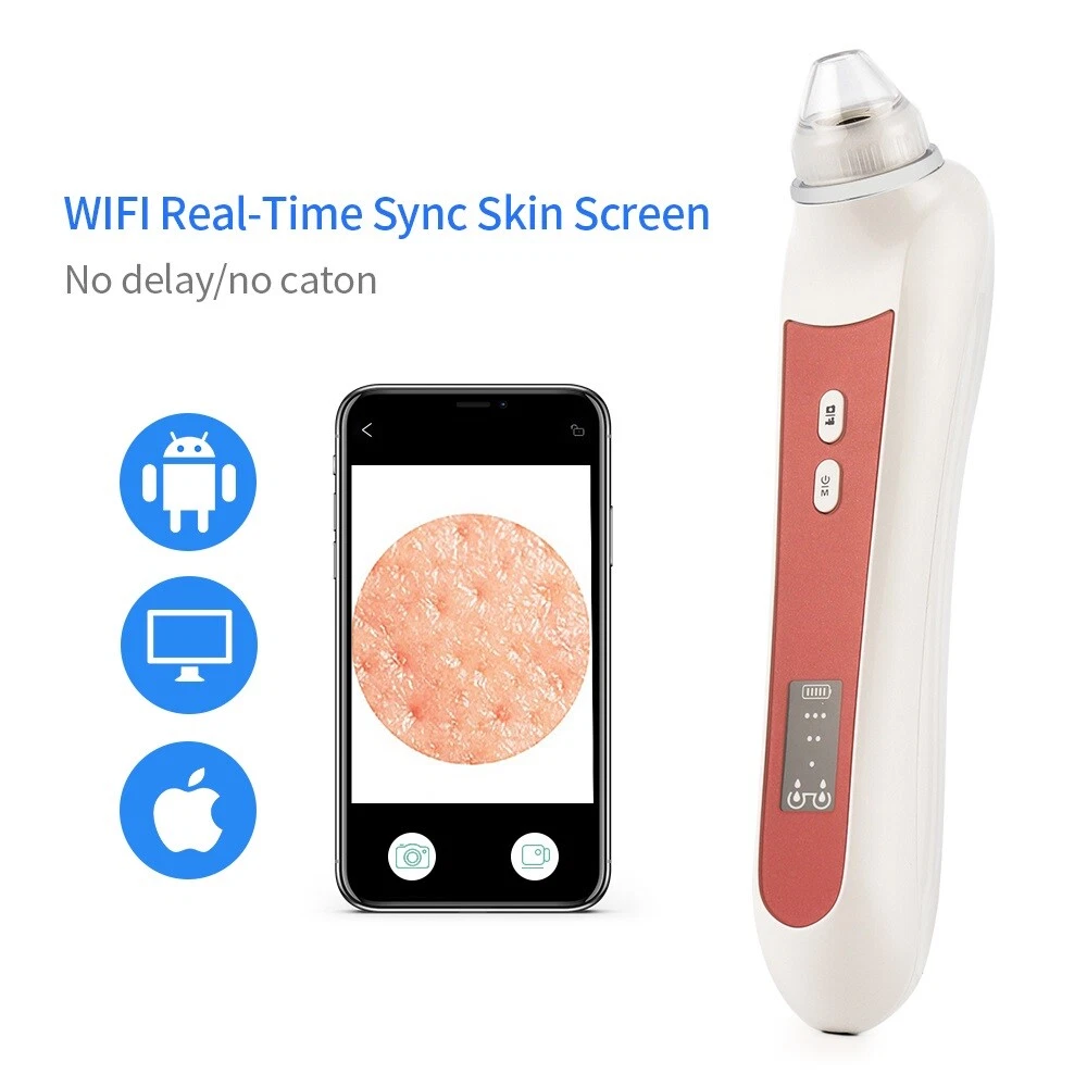 Pore vacuum with camera online