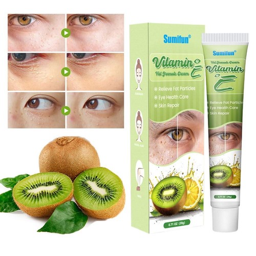 Vitamin Fat Granule Removal Eye Cream, Eye Health Care Repair Skin W8R6 - Picture 6 of 16