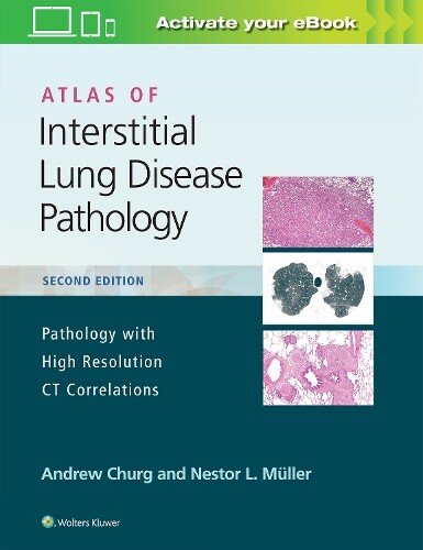 Thumbnail - Andrew Churg Nestor L. Atlas Of Interstitial Lung Disease Pa
