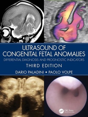 Ultrasound of Congenital Fetal Anomalies: Differential Diagnosis and Prognostic