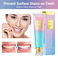 Niacinamide Whitening Toothpaste,Natural Niacinamide Toothpaste,Teeth Whitening