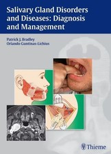 Salivary Gland Disorders and Diseases | Diagn...