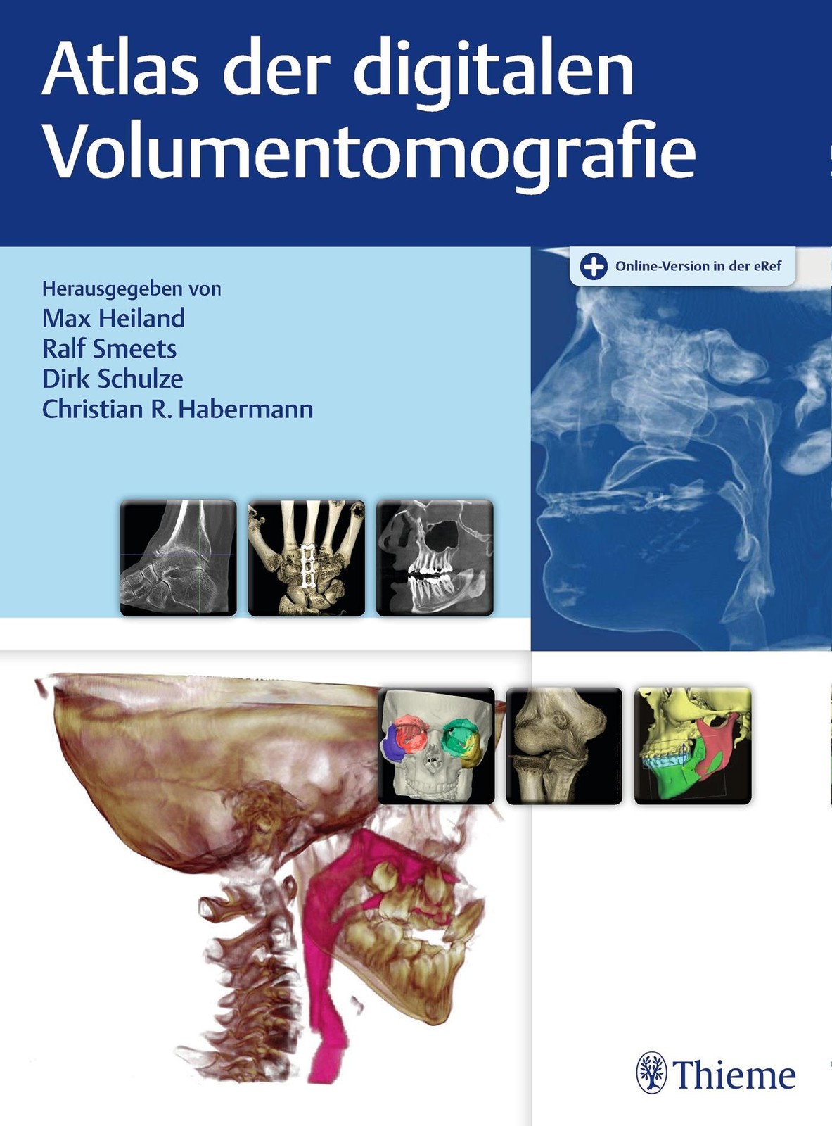 Thieme Atlas Der Digitalen Volumentomografie, Fachbücher Von Dirk Schulze, Christian R. Habermann, Max Heiland, Ralf Smeets - Bild 2