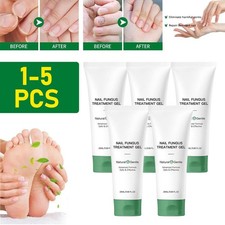 Anti Fungal Nail Treatment Toenail Fungus Fungi Nail Repair Foot Care Cream