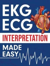 EKG  ECG Interpretation Made Easy: An Illustrated Study Guide For S - VERY GOOD