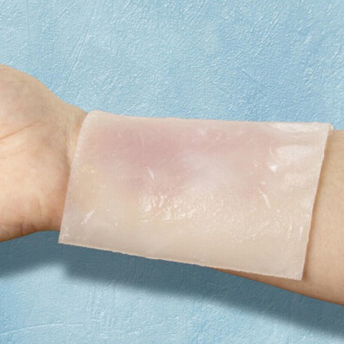 40G Burn Dressing Gel Hydrogel Sterile Trauma Dressing Healing For Woun-wu