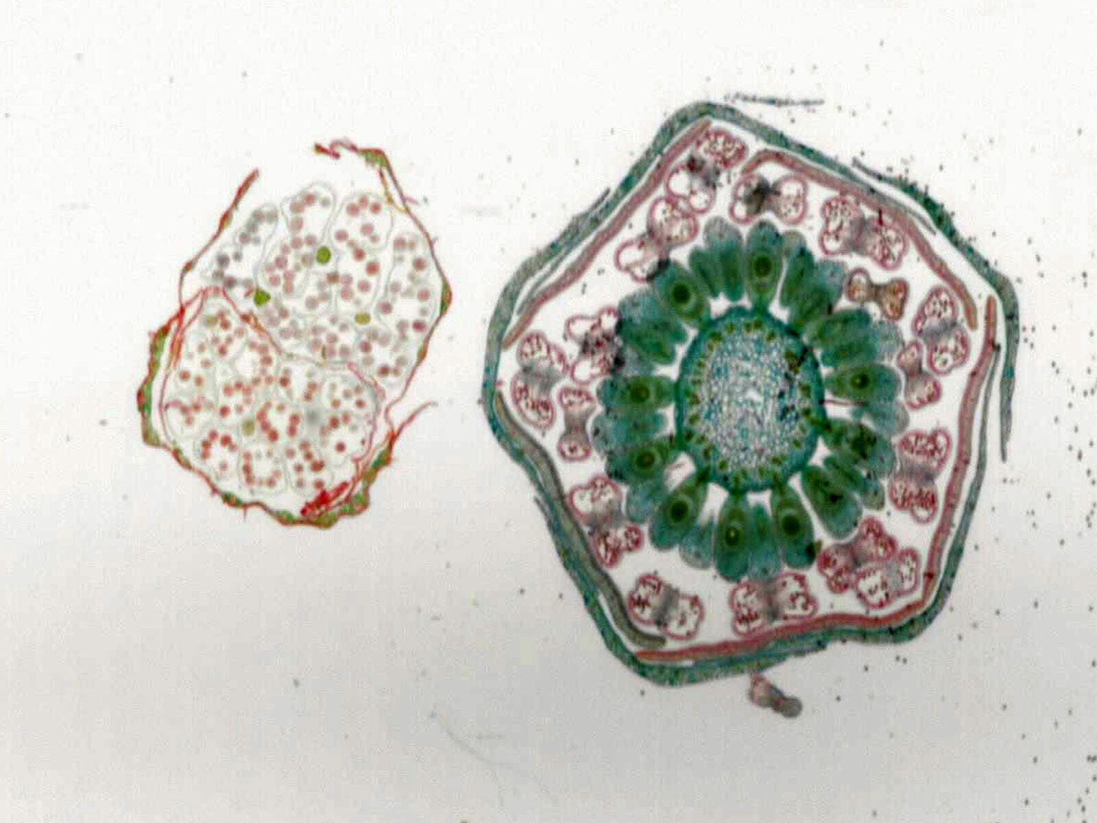 Monocot (Lily) and Dicot (Buttercup) Flower Buds Comparison; Cross Section