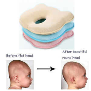 newborn flat head