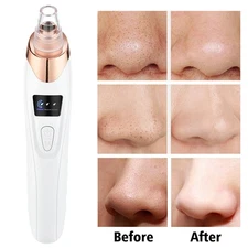 Electric Blackhead Remover Vacuum Face Pore Acne Cleaner with 5 Removable Heads