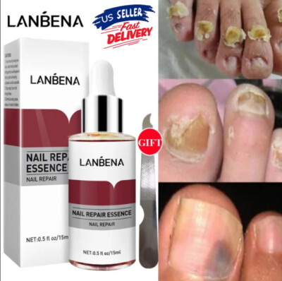 US Nail Repair Serum Fungal Nail Treatment Liquid Remove Toe Nail Fungus Essence