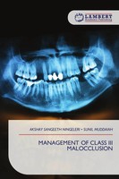 Akshay Sangeeth Ningeleri (U. A.) | Management OF Class III Malocclusion | Buch