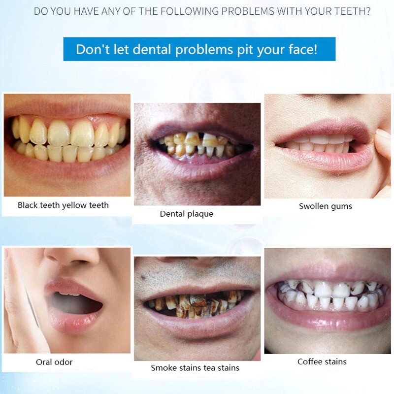 Coffee And Tea Stains On Teeth