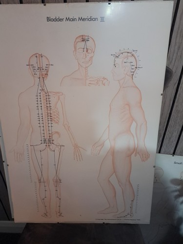 Vintage Rare Large Medical Posters 19 Total Job Lot 1970s Collectable Items - Picture 2 of 13