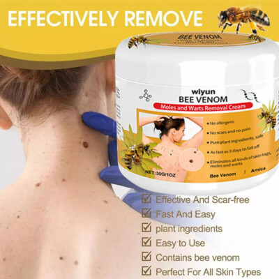  Bee Venom Skin Tag Removal Treatment Cream Body Care Mole Corn Wart Remover 