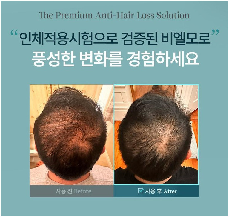 BensLab BLMo Scalp Toner Anti-Hair Loss Hair Tonic 120ml Soothing Cooling Effect