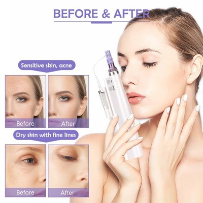 Face Beauty Skin Lifting Machine with Replace Cartridge Tip Anti-aging White New