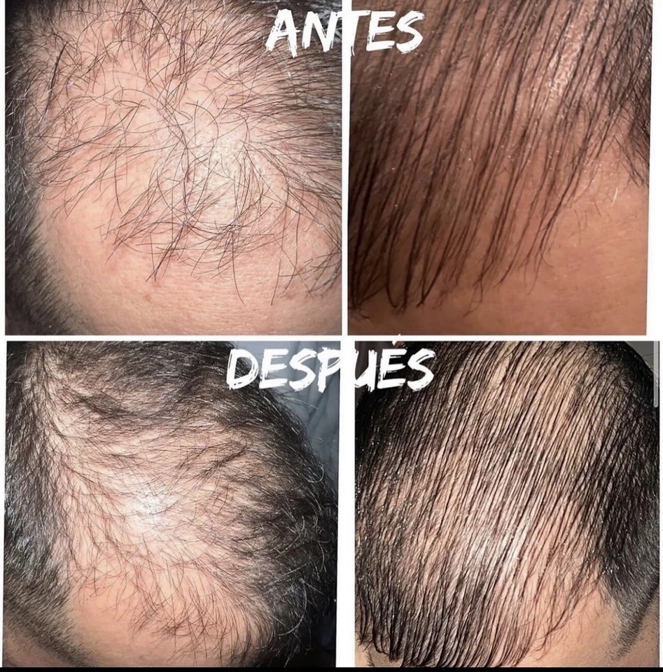 Gotero/tónico capilar control caída y crecimiento - Image 2 of 4