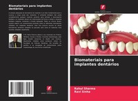 Biomateriais Para Implantes DentáRios Ravi Sinha