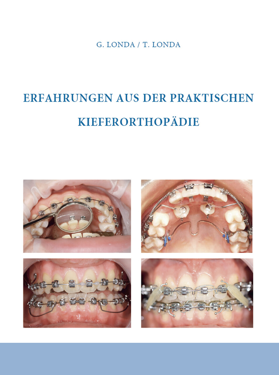Thumbnail - Erfahrungen Aus Der Praktischen Kieferorthopädie Gennadij Londa