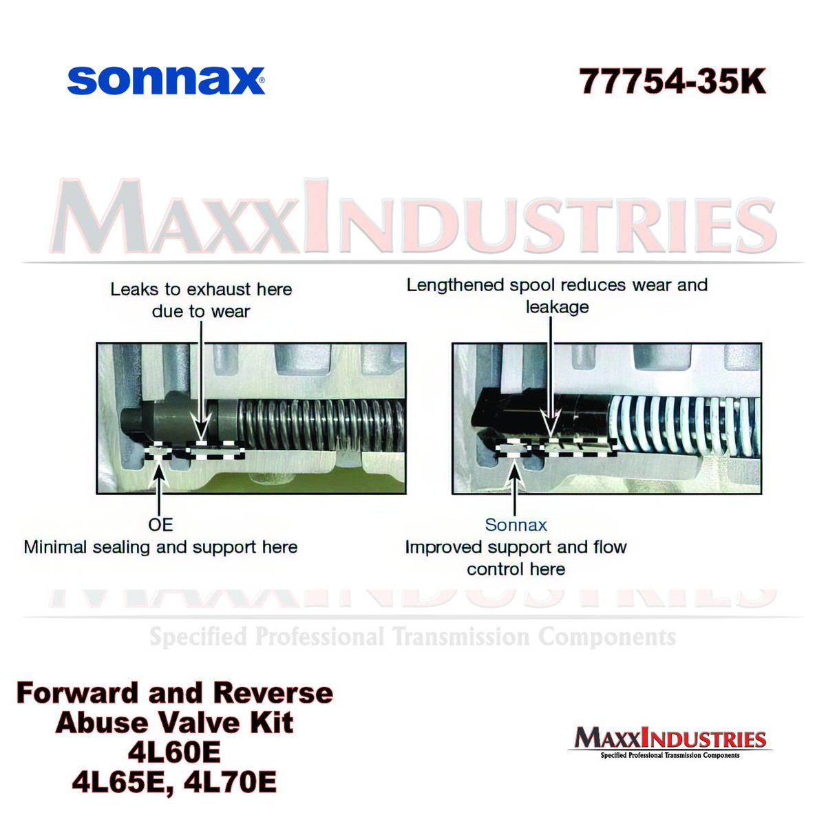 Sonnax 77754-35K Transmission Abuse Valve Kit, Forward