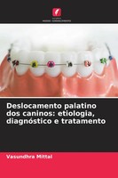 Vasundhra Mittal | Deslocamento Palatino Dos Caninos: Etiologia, DiagnóStico...