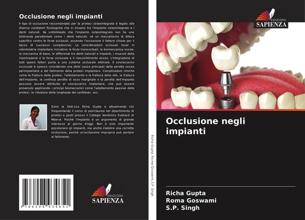 Occlusione Negli Impianti Roma Goswami-image