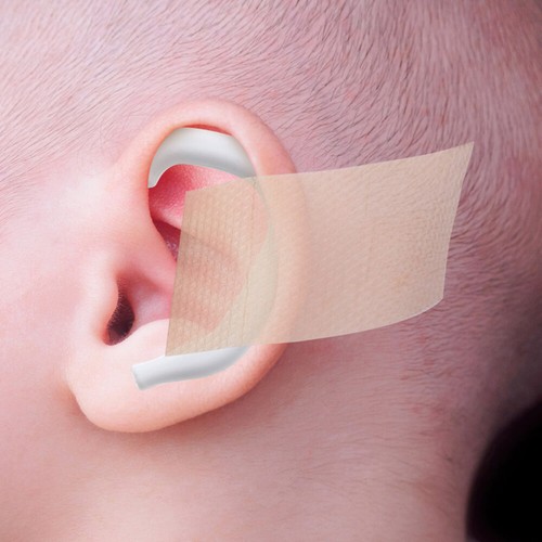 5 Pairs Baby Auricle Support External Auricle Corrector Protruding Ear Corrector - 第 7/12 張圖片