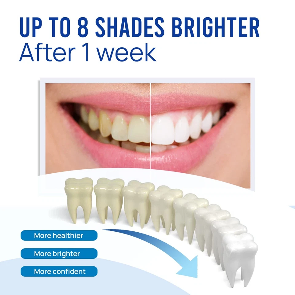 Pluma blanqueadora dental VieBeauti (3 piezas) 30+ usos efectiva sin dolor sin sensibilidad Foto 4 de 4